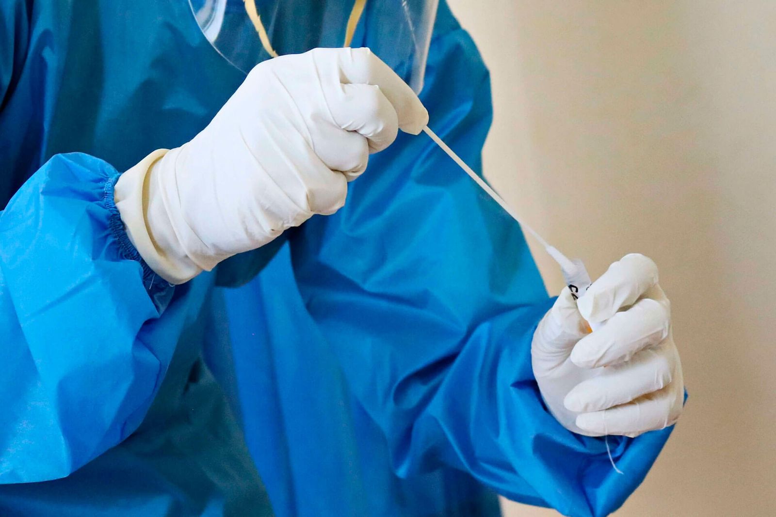 Anemia associada à doença renal crônica #3
